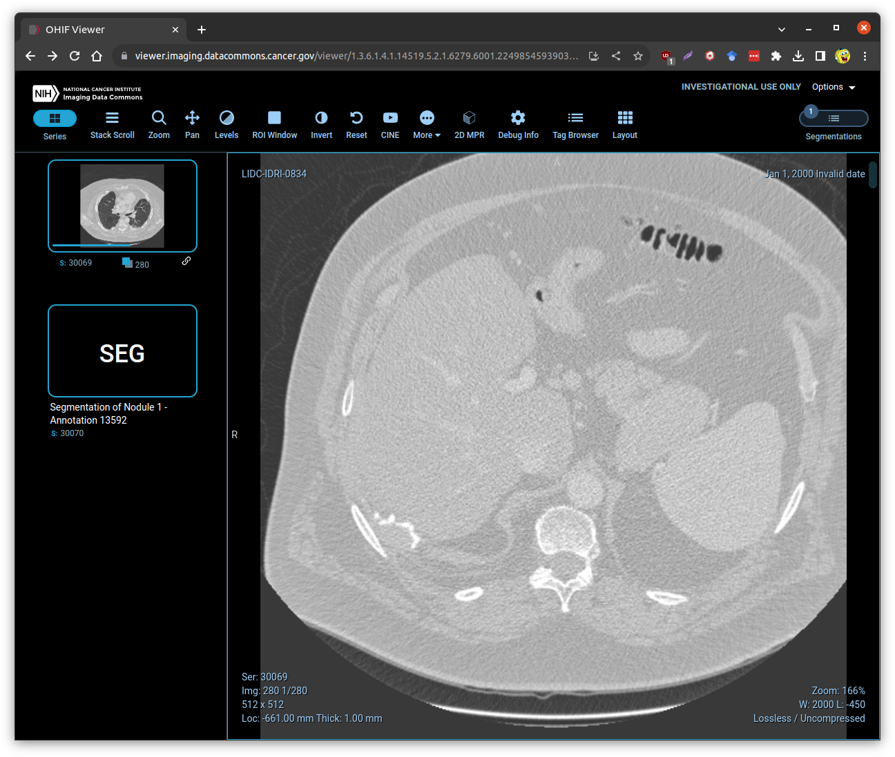 NCI Imaging Data Commons